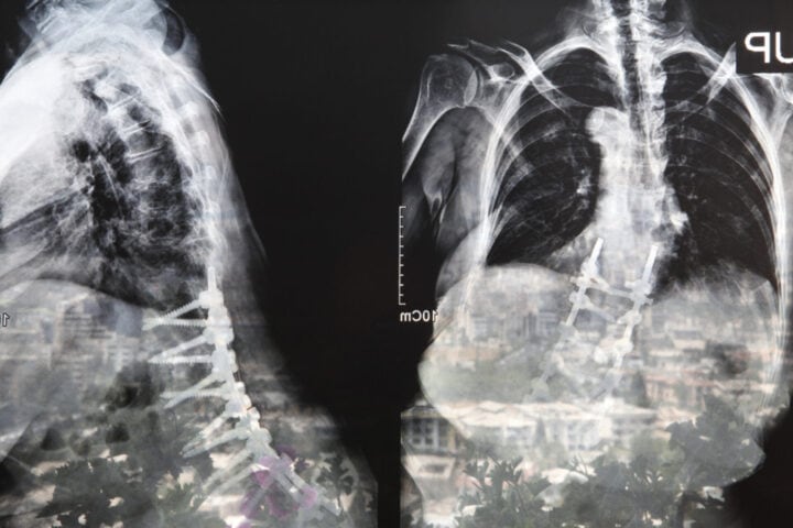 Radiograph of a Family